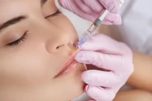 Lip Filler